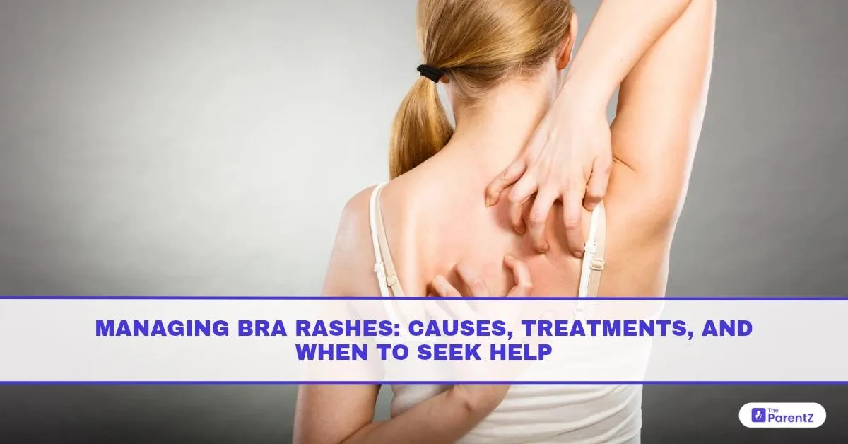 Managing Bra Rashes: Causes, Treatments, and When to Seek Help