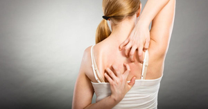 Managing Bra Rashes: Causes, Treatments, and When to Seek Help