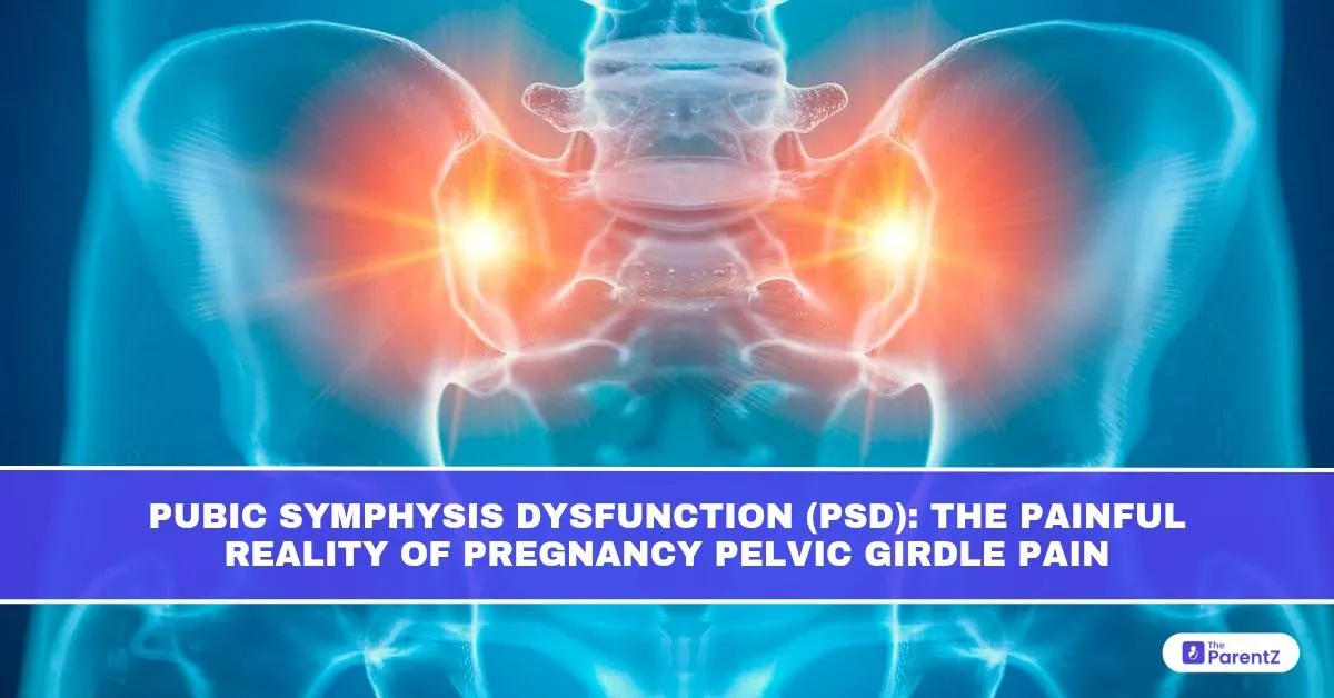 Pubic Symphysis Dysfunction (PSD): The Painful Reality of Pregnancy Pelvic Girdle Pain
