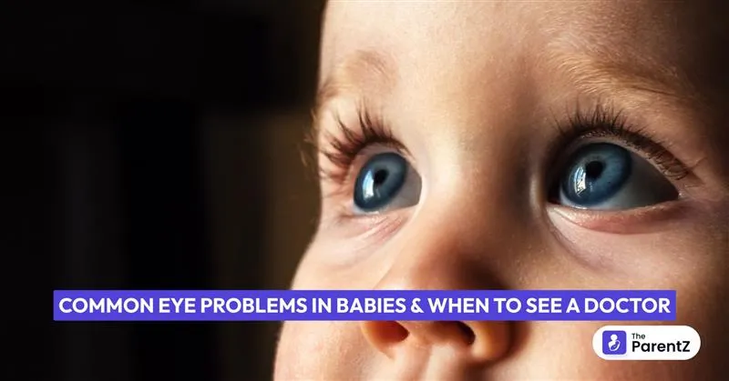 Common Eye Problems in Babies and When to See a Doctor