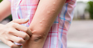 Insect Bites and Encephalitis: What Parents Need to Know