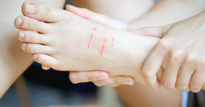 Stray Dog Encounters: A Parent’s Checklist for First Aid and Medical Aid