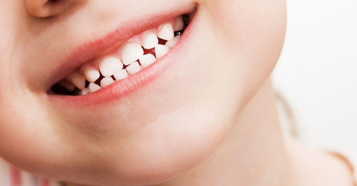 When do children get teeth? Teething Symptoms, Signs & Eruption Chart