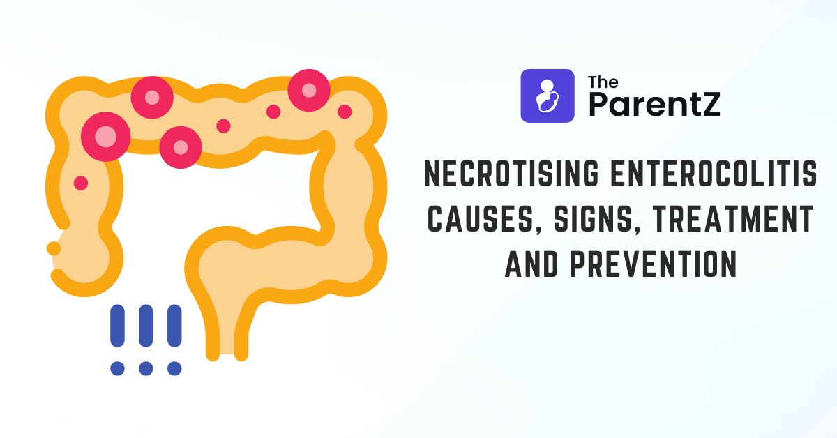 Necrotising Enterocolitis: Causes, Signs, Treatment and Prevention