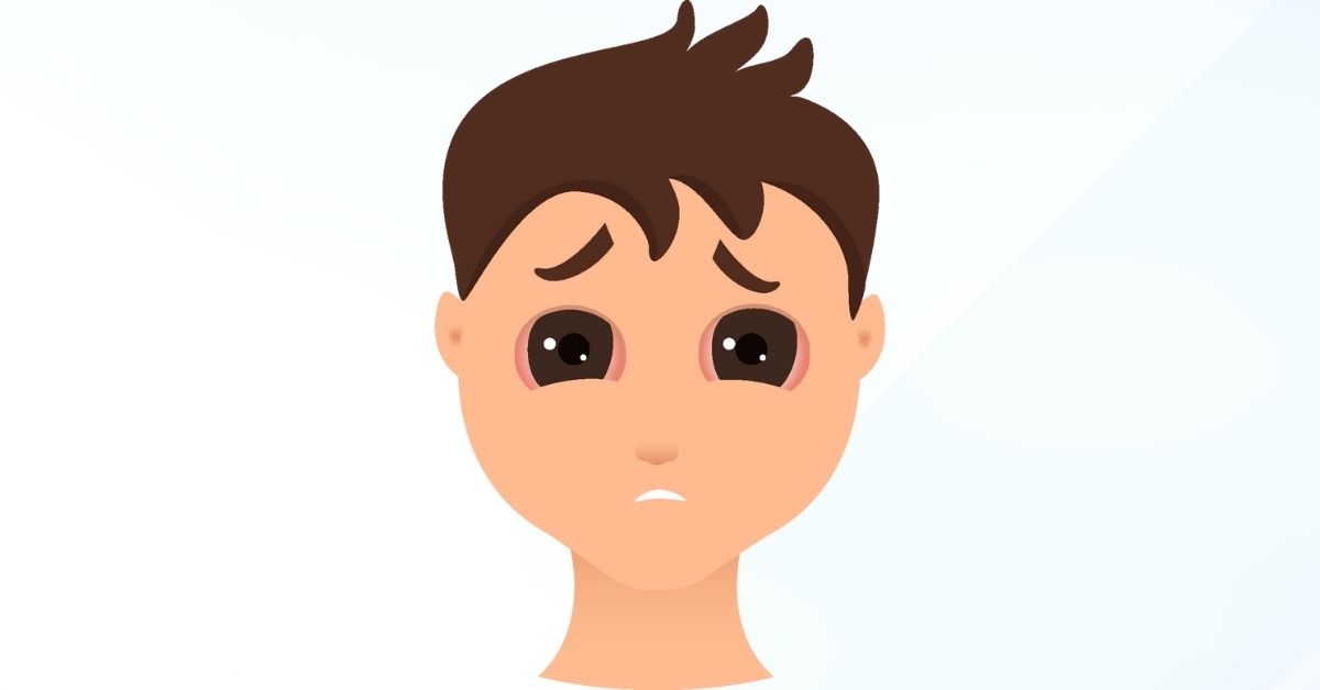 Pinkeye in Kids: Symptoms, Spread and Treatment