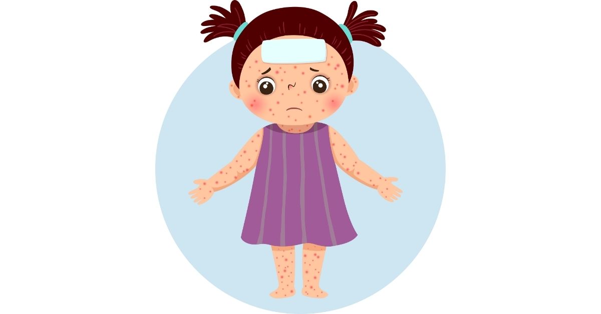 Rubella Vaccine: Symptoms, Side Effects and Spread