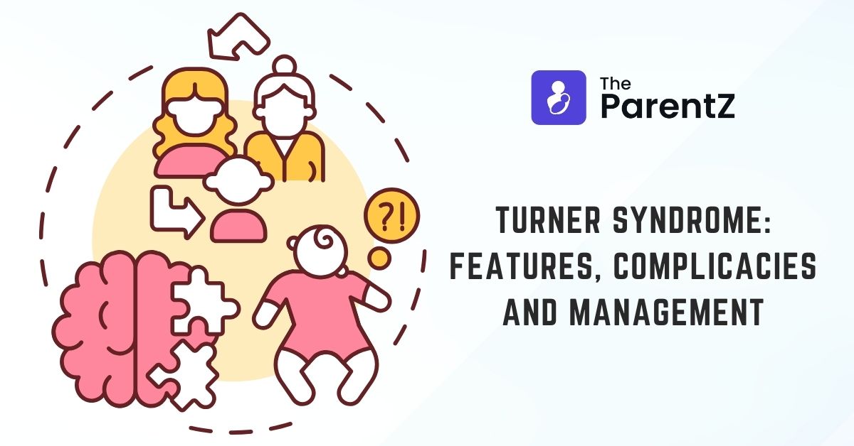 Turner Syndrome: Features, Complicacies and Management