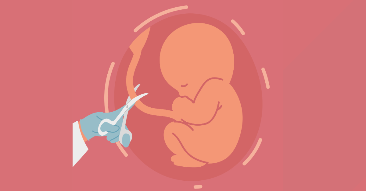 Umbilical Cord Care