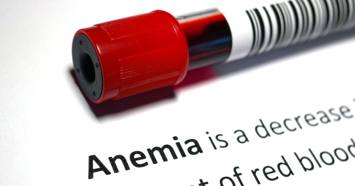 Anemia in pregnancy