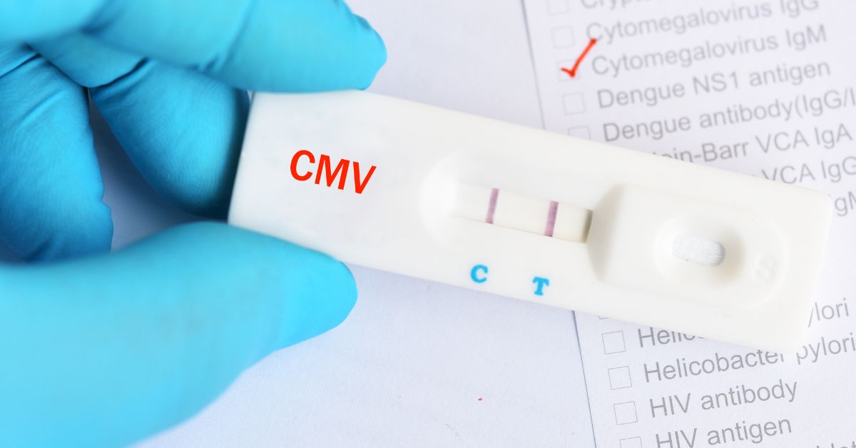 CMV in pregnancy