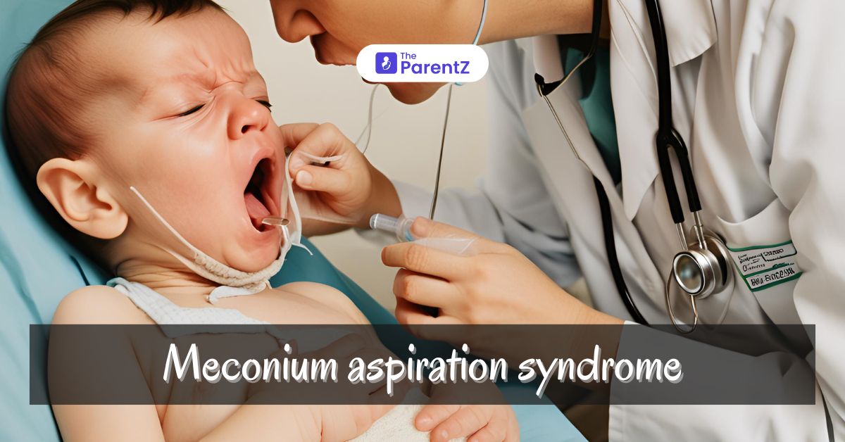Meconium Aspiration Syndrome