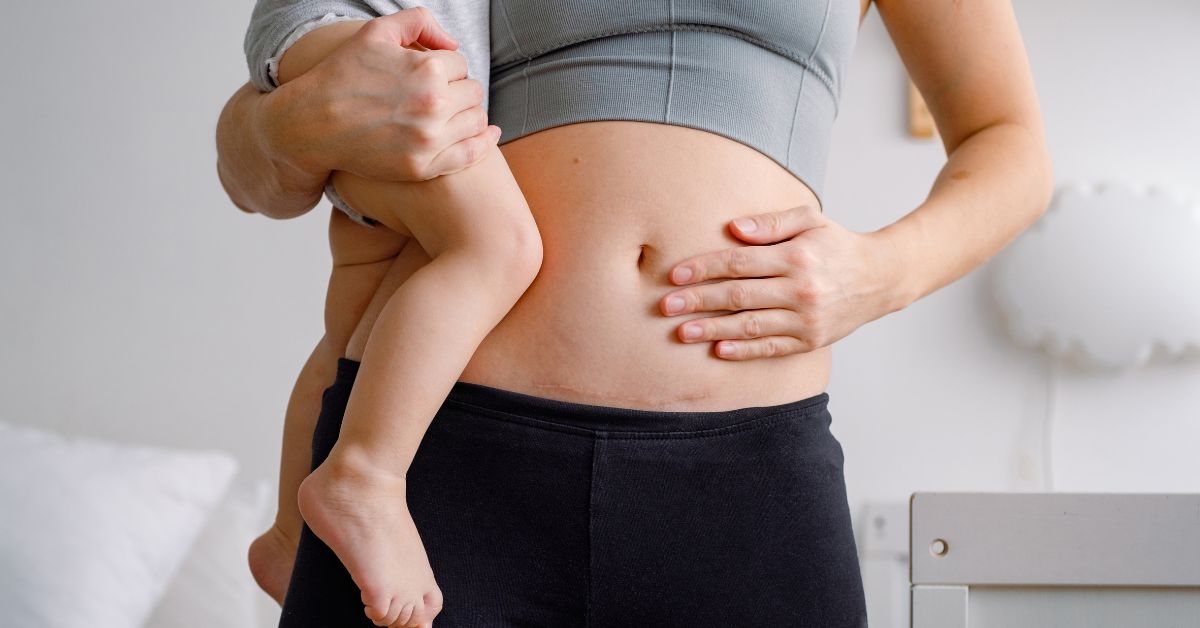 Preparing For a C Section: Here’s What You Need To Know