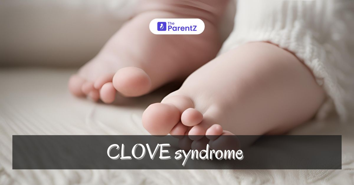 CLOVES Syndrome