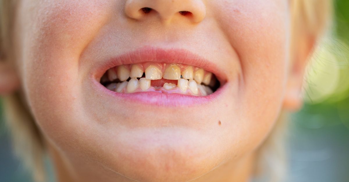 Nutritional Needs During Teething