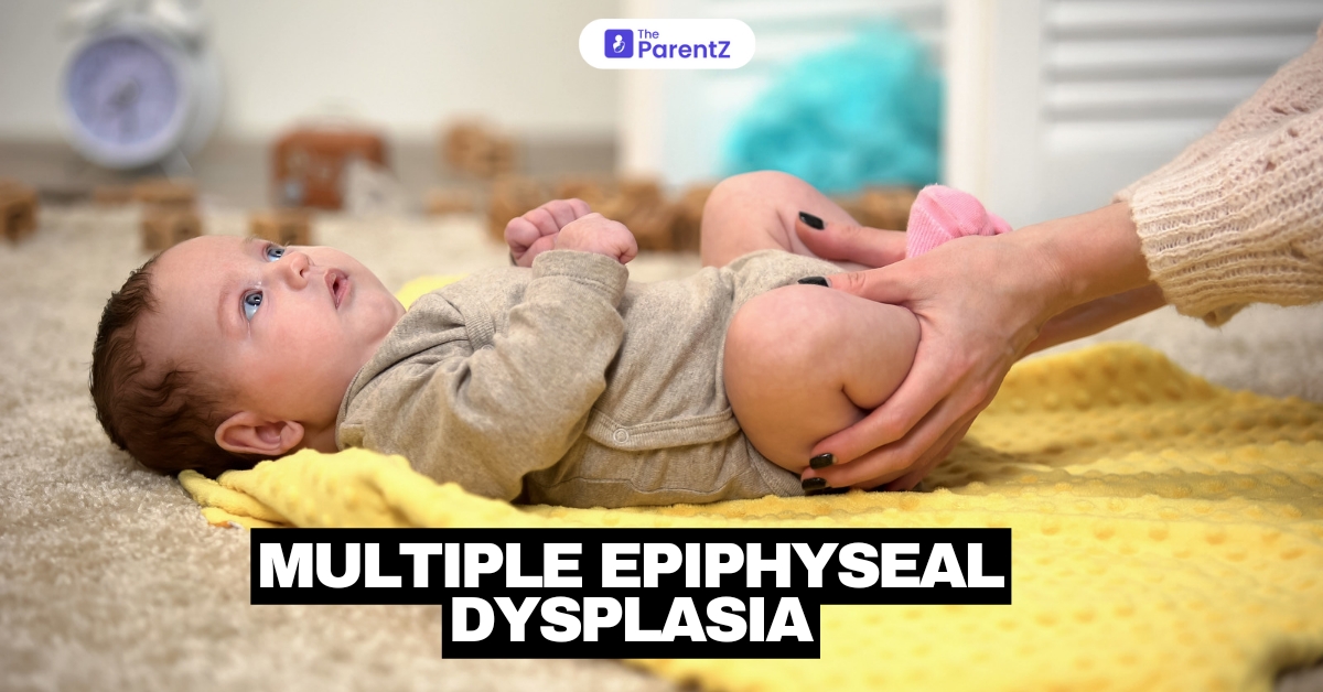 Multiple Epiphyseal Dysplasia