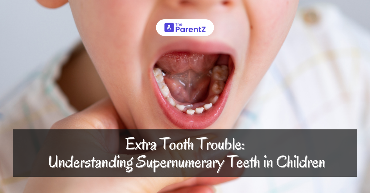 Extra Tooth Trouble: Understanding Supernumerary Teeth in Children