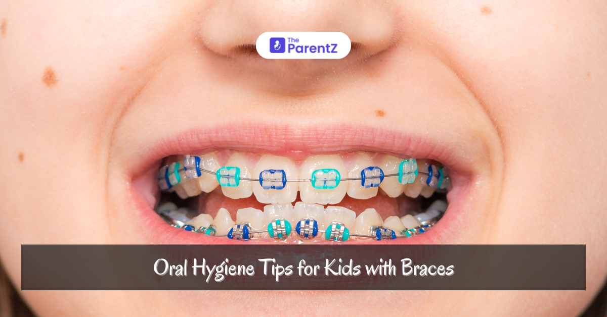 Oral Hygiene Tips for kids with braces